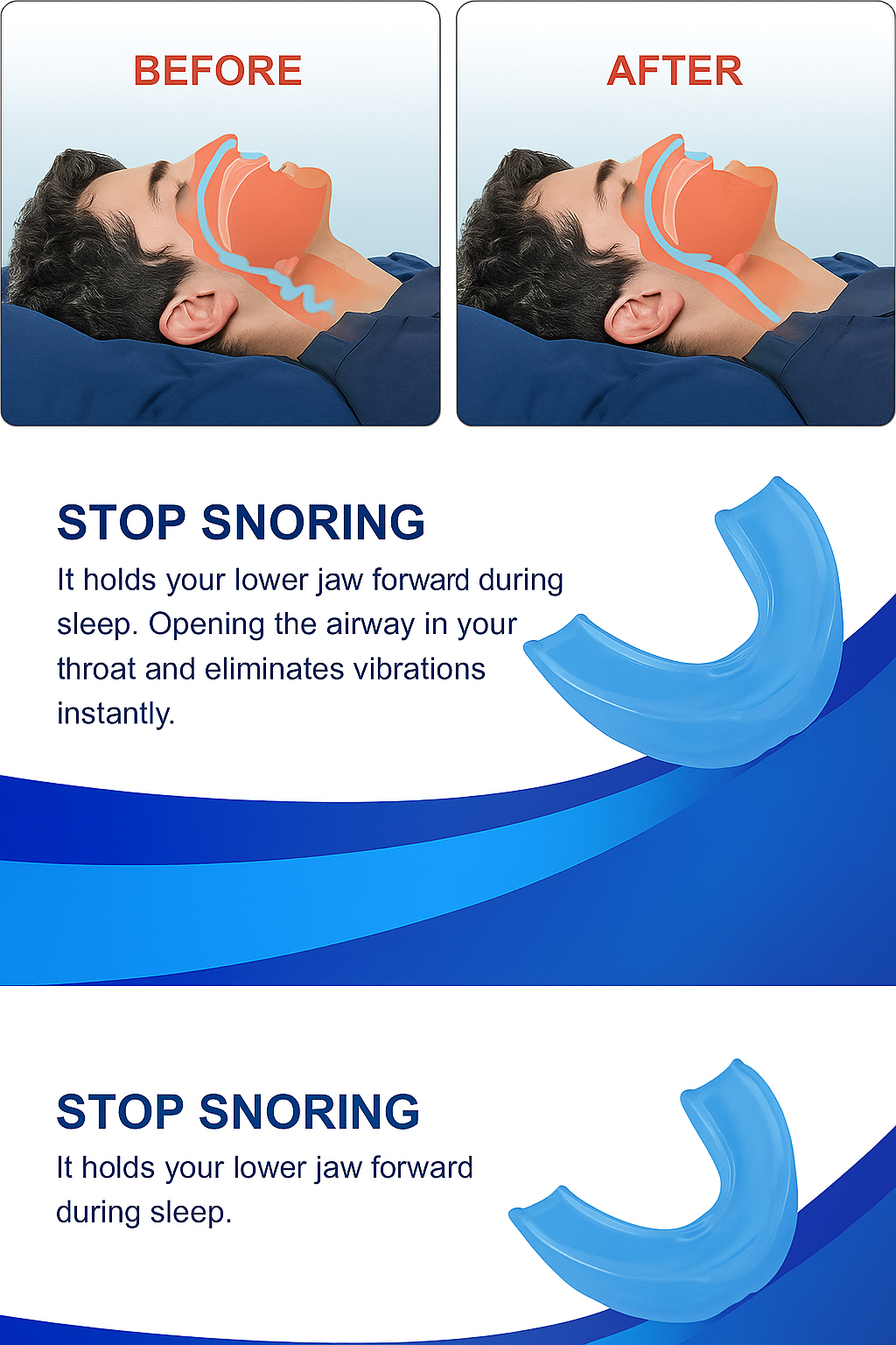 Quietra Anti-Snoring Mouthpiece